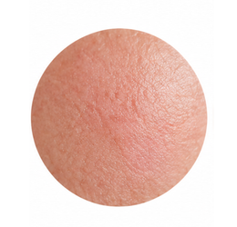 Sensitive Skin